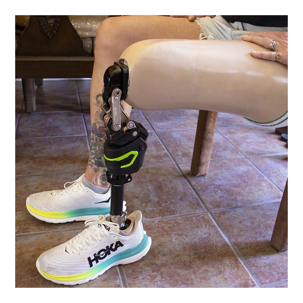 SLK™ 3.0 KD - Microprocessor Knee - Image 7